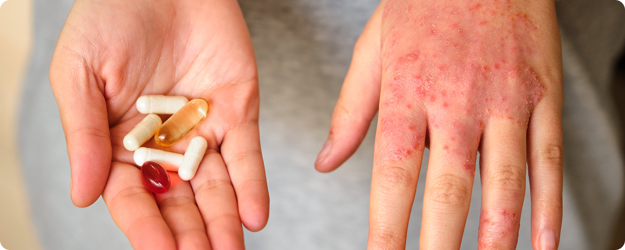 Allergy & Sensitivity Relief